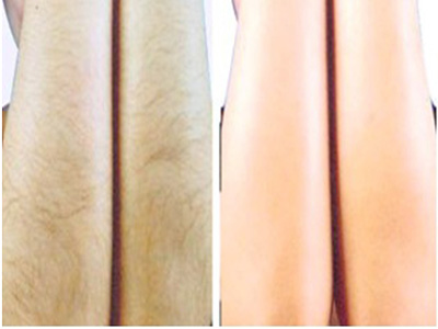 2023石家莊保妥適肉毒素注射前十強(qiáng)專家(任啟瑞、宋子軍、鄭鳳蘭技術(shù)、設(shè)備領(lǐng)先)