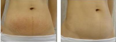 2023福州改善眼角皺紋專家排行榜前十位(徐婷婷、鄭少雄、李夢收費標準不貴)