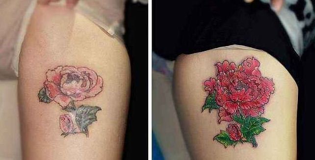 杭州填淚溝哪家醫(yī)院好？專家推薦的最佳醫(yī)療機(jī)構(gòu)