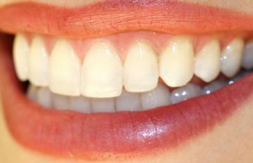 2023蘭州超聲刀去眼皺紋上榜清單前10強(qiáng)醫(yī)生(蘆蔓莉、蘇子平、加曉東優(yōu)點(diǎn)很明顯)