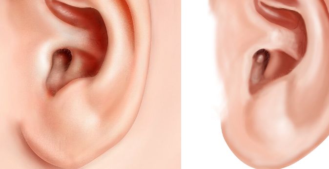 無(wú)錫看鼻子哪家醫(yī)院好？綜合評(píng)測(cè)揭秘?zé)o錫市專(zhuān)業(yè)鼻科醫(yī)院推薦