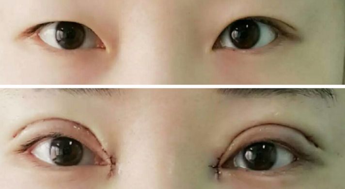 貴陽哪家醫(yī)院熱瑪吉效果好，值得推薦？