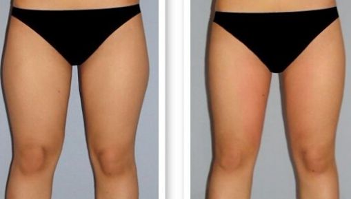 杭州疤痕醫(yī)院排名哪家好？揭秘杭州頂級疤痕醫(yī)院榜單！