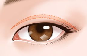 上海激光祛痣哪家醫(yī)院效果最好？