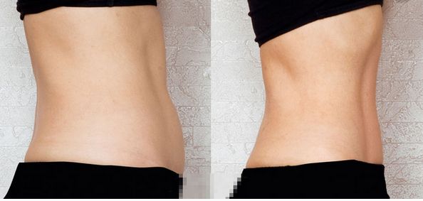 上海祛斑術(shù)哪家醫(yī)院好？解讀上海祛斑術(shù)醫(yī)院排名和專家推薦