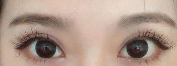 西安哪家醫(yī)院的激光祛痘項目質(zhì)量好？