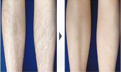 哈爾濱哪家醫(yī)院祛斑好？-排名第一的專業(yè)醫(yī)院，讓您擁有無(wú)瑕疵肌膚！