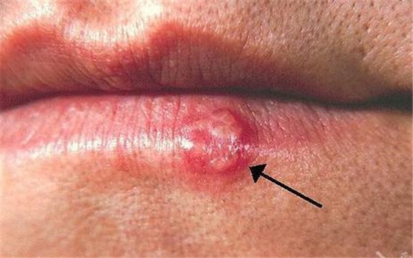 2023婁底熱瑪吉祛額頭紋排名前十醫(yī)生(邱敏、潘葵、蔣松林預(yù)約掛號(hào)攻略)