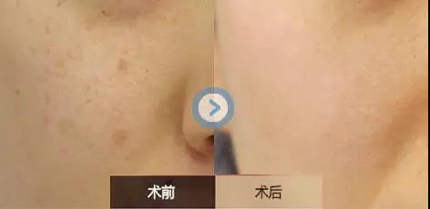 2023沈陽(yáng)美膚祛斑專家上榜名單前10(敖彩虹、黎寶川、王志濤實(shí)力與口碑滿分！)