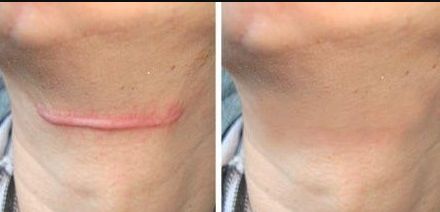 成都市開(kāi)眼角醫(yī)院哪家好？選擇適合你的開(kāi)眼角醫(yī)院