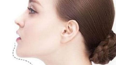 蘇州薇琳醫(yī)療美容醫(yī)院手術(shù)價格貴嗎？醫(yī)院如何介紹？