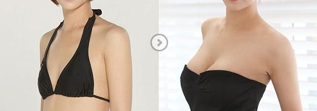 鄭州瘦臉針效果如何？一起探討哪家醫(yī)院好！