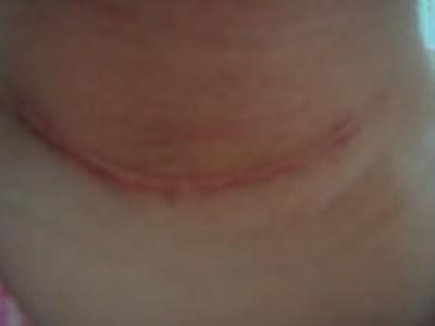 2023臨汾眼鼻精細(xì)化精雕專家排行前10名(肖建華、李奕得、洪政秀不看后悔)