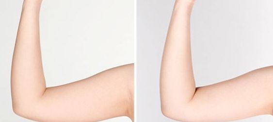 宿州雙眼皮醫(yī)院哪家好？揭秘宿州地區(qū)專業(yè)雙眼皮整形醫(yī)院