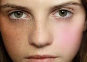 宿州疤痕修復(fù)醫(yī)院哪家好？幫你選擇最適合的宿州疤痕治療專科醫(yī)院