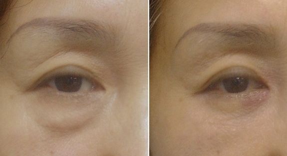 解放軍總裝備部后勤部亞運(yùn)村門診部怎么樣？解放軍總裝備部后勤部亞運(yùn)村門診部簡(jiǎn)介|醫(yī)生團(tuán)隊(duì)|口碑評(píng)價(jià)！