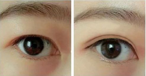 合肥熱瑪吉哪家醫(yī)院好？優(yōu)質(zhì)服務與專業(yè)技術讓您擁有完美體驗。