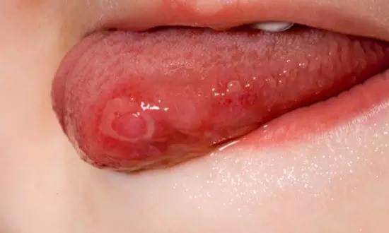 2023廣東內(nèi)切眼袋手術(shù)排行前十位專(zhuān)家(杜永軍、蔡劍芳、王綏江深得老用戶口碑)