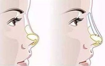 河南中醫(yī)藥大學第一附屬醫(yī)院整形科技術與醫(yī)生表現(xiàn)口碑如何？