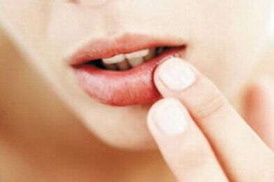 2023濟(jì)南激光祛眼睛細(xì)紋醫(yī)生前10強(qiáng)排名榜(李文德、王曉林、趙峰值得信賴和選擇！)