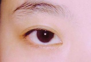 西安看胎記醫(yī)院哪家好？選擇胎記專科醫(yī)院，專業(yè)技術(shù)得到用戶好評(píng)！