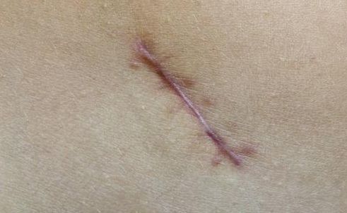 重慶整形技術，哪家醫(yī)院好？探尋重慶整形技術最佳醫(yī)院有哪些