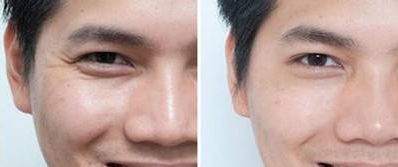 南京哪家整形醫(yī)院隆鼻效果最好？