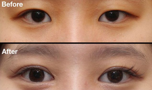 昆明刀疤修復(fù)哪家醫(yī)院好？挑選昆明專業(yè)刀疤修復(fù)醫(yī)院的技巧與要點(diǎn)