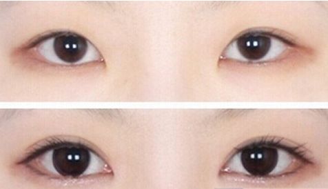 濟南哪家醫(yī)院的豐胸手術(shù)效果最好？