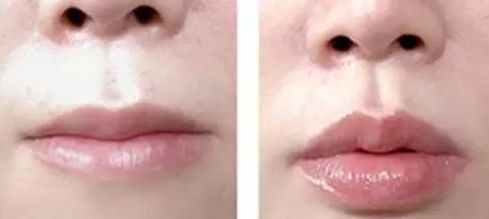 2023溫州微雕去魚尾紋在榜單前10位專家(楊澤安、徐開亞、張簡(jiǎn)仕煌高端品牌實(shí)力高)