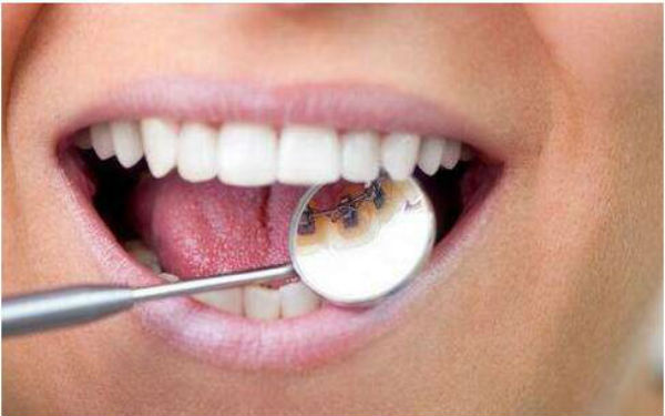 2023長沙下巴后縮正畸醫(yī)生TOP10強口碑排行(寧勝、嚴友才、黃新凡評價一致贊美)