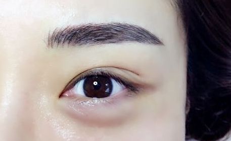 吉安哪家整形醫(yī)院的美容效果好？