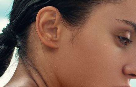 福州胎記?？漆t(yī)院哪家好？解析福州市胎記治療醫(yī)院排名