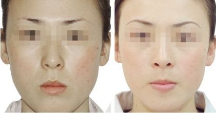 紹興市整形醫(yī)院排名及口碑評(píng)價(jià)：哪家紹興醫(yī)療整形醫(yī)院好