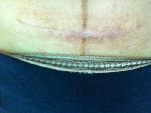 2023深圳切口拉皮正規(guī)醫(yī)生評(píng)分(范明明、黃丹丹、張干林強(qiáng)勢(shì)推薦~)