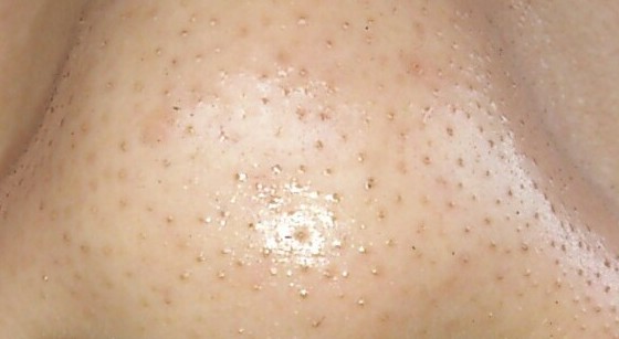 2023承德自體脂肪填充塑型前十名的專家(魏國祥、王紅、韓永剛都是高人氣專家！)