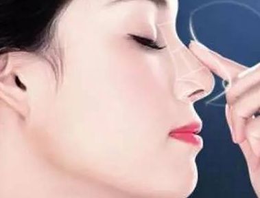 上海激光祛斑手術哪家好，選擇專業(yè)激光美容醫(yī)院聰明之選