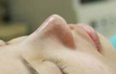 南京抽脂瘦身哪家醫(yī)院好？選對(duì)醫(yī)院是明智之舉！