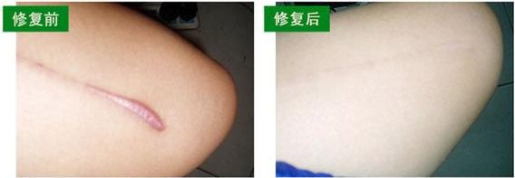 新鄉(xiāng)市眼袋手術(shù)哪家好？選擇新鄉(xiāng)市口碑最佳的眼袋手術(shù)醫(yī)院