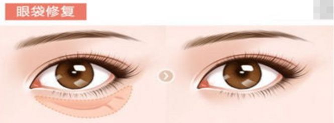 上海自體豐面部醫(yī)院排名榜單及評(píng)價(jià)對(duì)比[詳細(xì)分析]