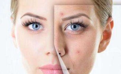 杭州激光去雀斑哪家效果好-選擇最適合您的杭州激光去雀斑治療中心