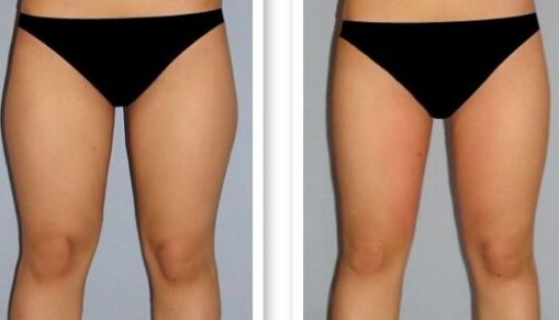 長沙哪家激光點痣醫(yī)院口碑好？