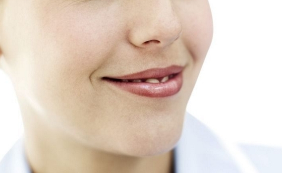 2023上海頸部抽脂排名醫(yī)生(張桂蓉、郭磊磊、王中秒口碑技術(shù)杠杠)