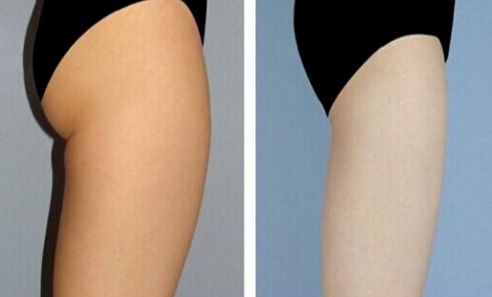 上海改臉型整形哪家醫(yī)院好？專家推薦悅美人整形醫(yī)院！