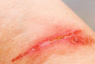 重慶去眼袋醫(yī)院哪家好？專業(yè)醫(yī)生推薦最佳醫(yī)院解決眼袋問(wèn)題