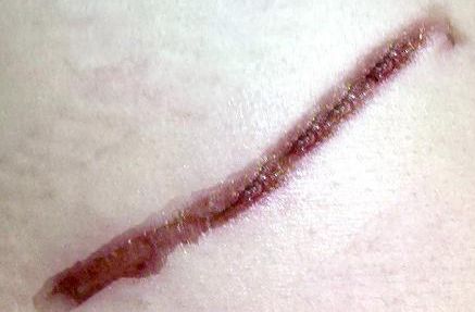 吉林市眼袋修復(fù)哪家醫(yī)院好？