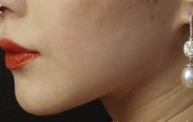 2023深圳咬肌變小瘦臉醫(yī)生推薦前10強(qiáng)(白云、李鵬、羅文關(guān)注度不斷攀升)