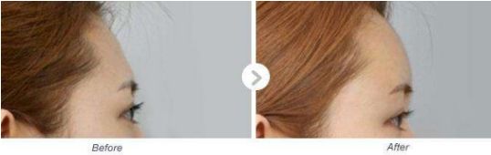 河南有哪家專業(yè)的小腿抽脂醫(yī)院值得推薦？