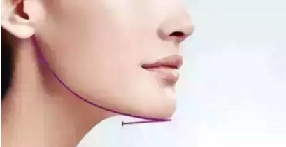 蘭州雀斑問題煩惱？快來尋找最佳治療方法，推薦多家正規(guī)醫(yī)院！