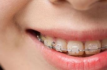 2023濟(jì)寧面部皺紋除皺針權(quán)威醫(yī)生榜單前10位(李春燕、朱汝崗、劉郭專注技術(shù)提升)